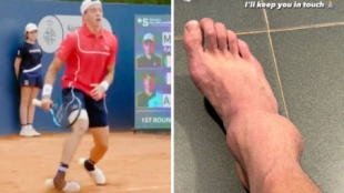 Cazaux revela la gravedad de su lesión en el tobillo