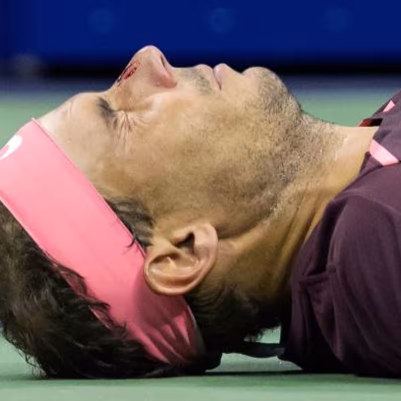 Nadal explica qué siente en la nariz tras el fuerte golpe con su raqueta
